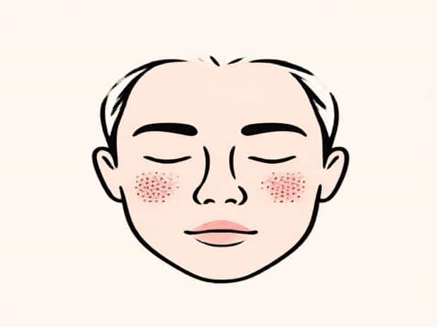 Get Rid Of Tiny Bumps On Face