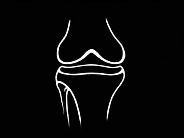 Morphology Of Ligamentum Patellae