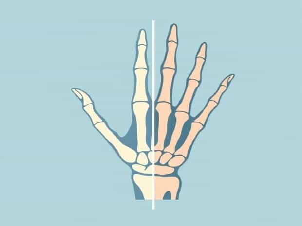Difference Between Carpus And Metacarpus