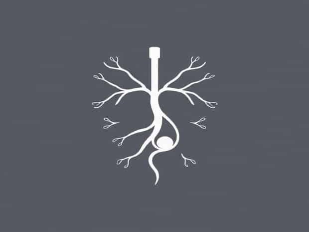 Is Lacteal A Lymphatic Vessel