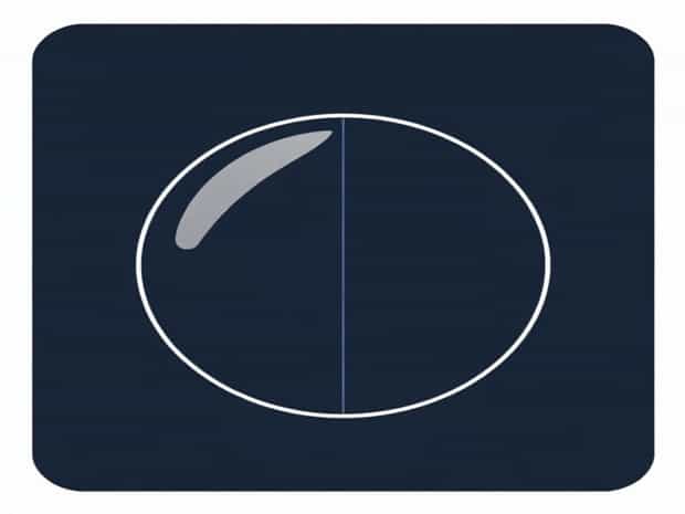 Difference Between Concave And Convex Lens
