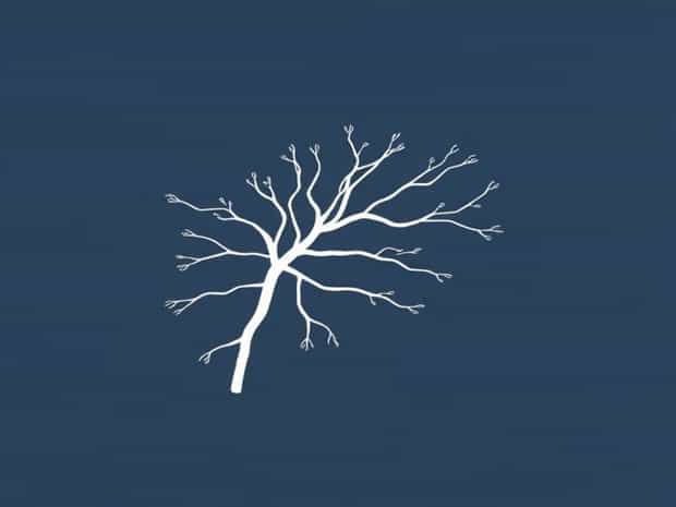 Branches Of External Jugular Vein