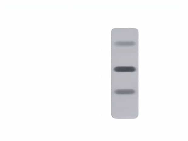 Can Western Blot Quantify Protein