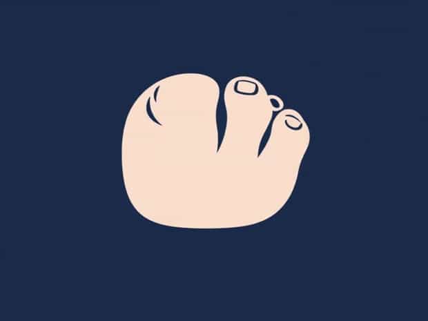 Get Rid Of Hangnail On Big Toe