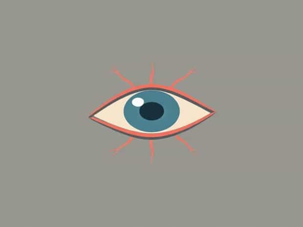 Is The Ophthalmic Artery?