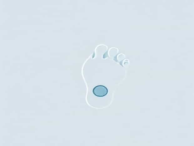 Keyhole Bunion Surgery Uk Cost