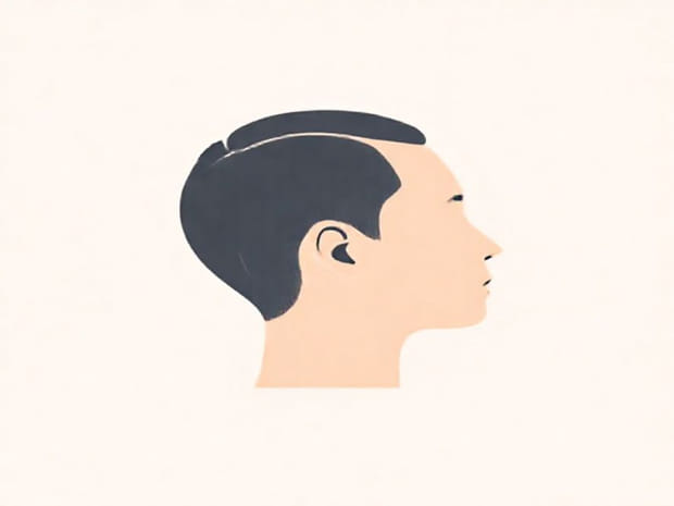 Is Androgenic Alopecia Autoimmune
