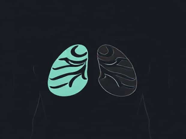 Is Chest Pain Concerning