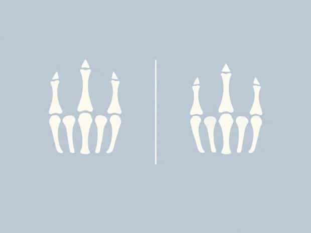 Difference Between Phalanx And Phalanges