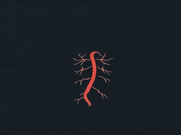 How Do You Pronounce Arteriosclerosis