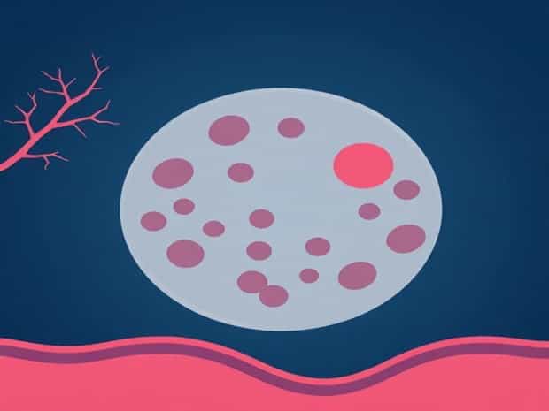 Endothelial Cell Proliferation And Migration Is Promoted By Endothelial Lining