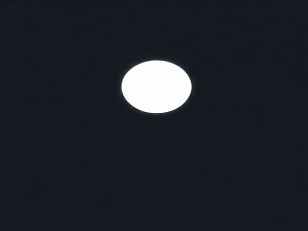 Explain Why The Lunula Has A Whitish Appearance