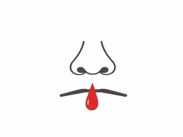 How To Stop A Bloody Nose