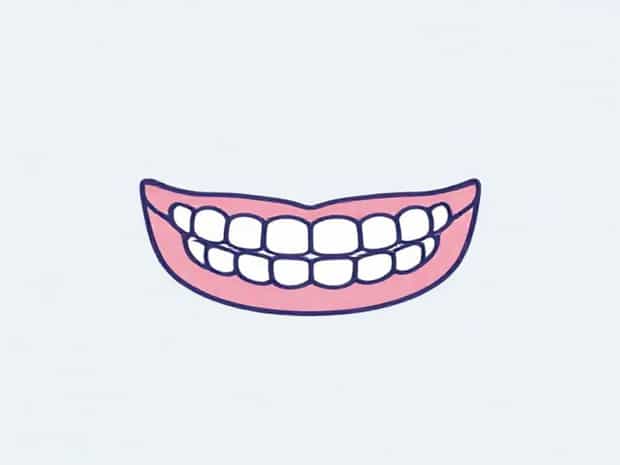 Is A Mouth Guard Considered Orthodontia