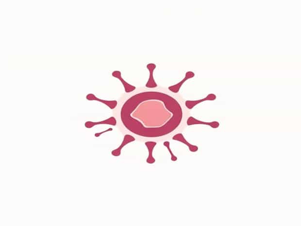 Keratin Made By Neoplastic Cells